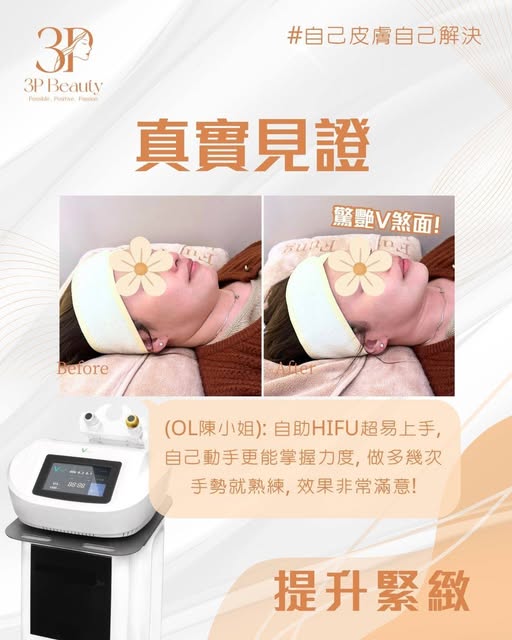 3P Beauty 顧客自助 HIFU 緊緻護理公開見證